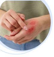 Slow-healing wounds or frequent infections